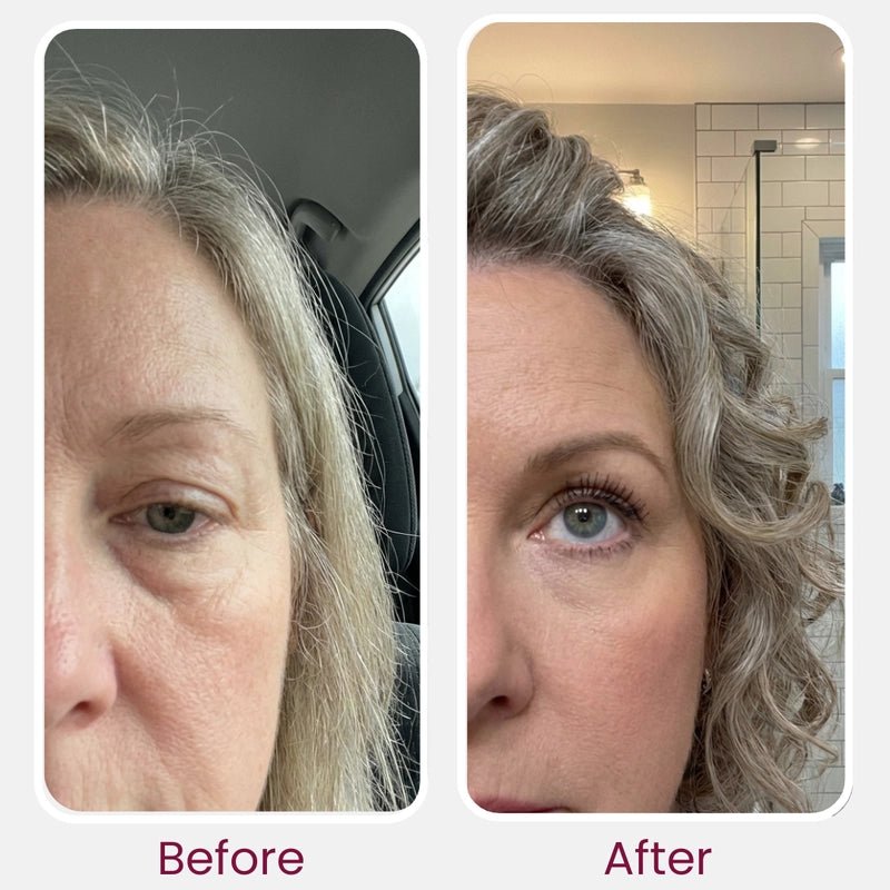 Weeks 4 to 6: skin and face before and after